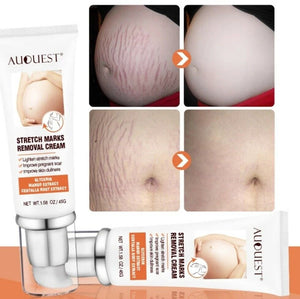 Stretch Mark Remover Repair Cream For Postpartum Pregnancy Scar  Skin Care